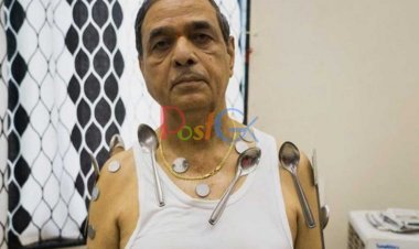 यह व्यक्ति वैक्सीन लेने के बाद चुंबक बन गया। लोहे, सिक्के सभी उसके शरीर से चिपके रहते हैं, देखें वीडियो