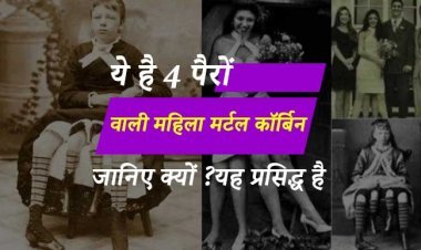 ये है 4 पैरों वाली महिला मर्टल कॉर्बिन, जानिए क्यों ?? यह प्रसिद्ध है