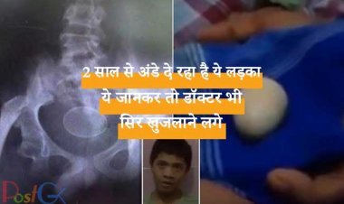 2 साल से अंडे दे रहा है ये लड़का, ये जानकर तो डॉक्टर भी सिर खुजलाने लगे