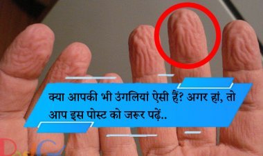 क्या आपकी भी उंगलियां ऐसी हैं? अगर हां, तो आप इस पोस्ट को जरूर पढ़ें..